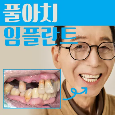 다산바른치과의원 — 업체가 네이버 플레이스에 올린 사진 3