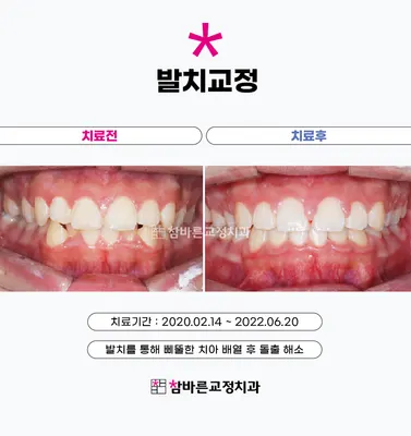 참바른치과교정과치과의원 — 업체가 네이버 플레이스에 올린 사진 2