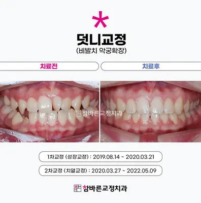 참바른치과교정과치과의원 — 업체가 네이버 플레이스에 올린 사진 3