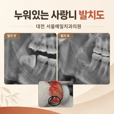 서울예일치과의원 — 업체가 네이버 플레이스에 올린 사진 2