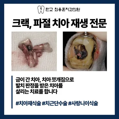 판교 최용훈치과의원 — 업체가 네이버 플레이스에 올린 사진 2