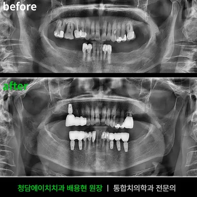 청담에이치치과의원 포항양덕점 — 업체가 네이버 플레이스에 올린 사진 3