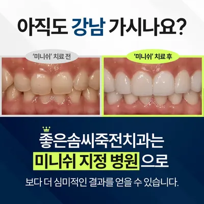좋은솜씨죽전치과의원 — 업체가 네이버 플레이스에 올린 사진 3