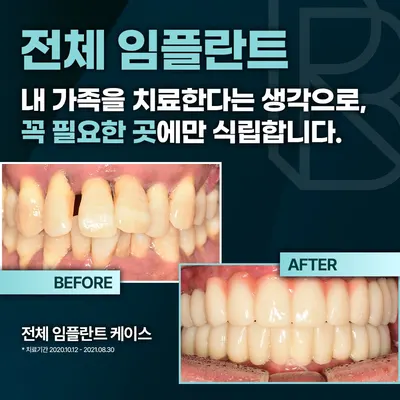 리봄치과의원 — 업체가 네이버 플레이스에 올린 사진 3