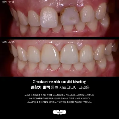 유앤아이시카고치과의원 — 업체가 네이버 플레이스에 올린 사진 3