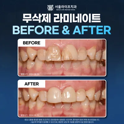 서울라이프치과의원 — 업체가 네이버 플레이스에 올린 사진 3