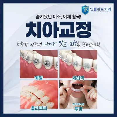 인플란트 치과의원 — 업체가 네이버 플레이스에 올린 사진 3