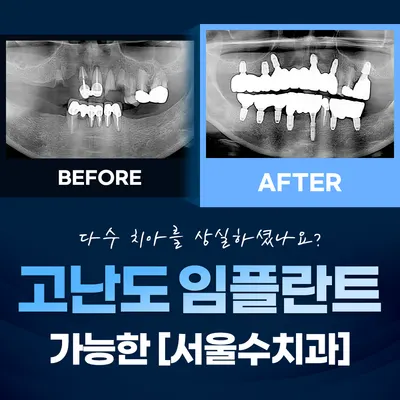 서울수치과의원 청주 — 업체가 네이버 플레이스에 올린 사진 2