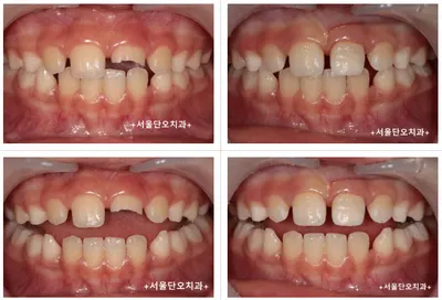 서울단오치과의원 — 업체가 네이버 플레이스에 올린 사진 2