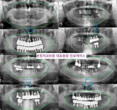 본정치과의원 — 업체가 네이버 플레이스에 올린 사진 2