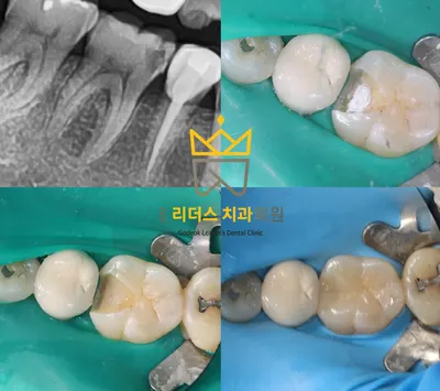 고덕리더스치과의원 — 업체가 네이버 플레이스에 올린 사진 2