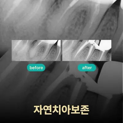 루민치과의원 — 업체가 네이버 플레이스에 올린 사진 3