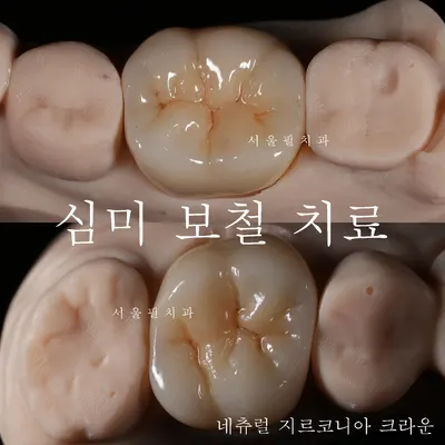 서울필치과의원 — 업체가 네이버 플레이스에 올린 사진 2