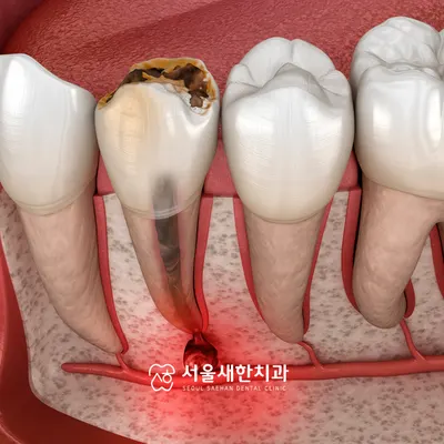 서울새한치과의원 — 업체가 네이버 플레이스에 올린 사진 3