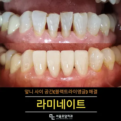 서울모담치과의원 — 업체가 네이버 플레이스에 올린 사진 2