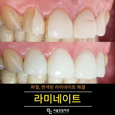 서울모담치과의원 — 업체가 네이버 플레이스에 올린 사진 3