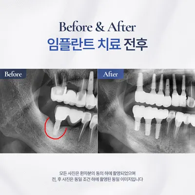 미소천사치과의원 — 업체가 네이버 플레이스에 올린 사진 3
