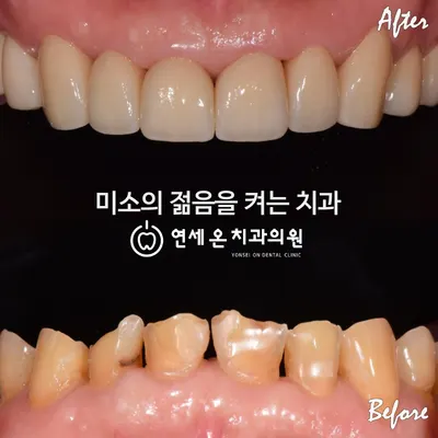 연세온치과의원 부산 동래 — 업체가 네이버 플레이스에 올린 사진 1
