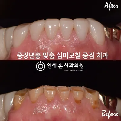 연세온치과의원 부산 동래 — 업체가 네이버 플레이스에 올린 사진 2