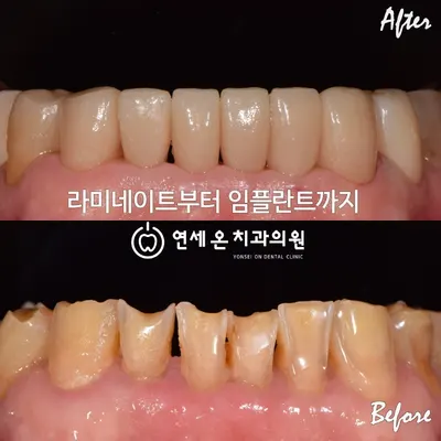 연세온치과의원 부산 동래 — 업체가 네이버 플레이스에 올린 사진 3