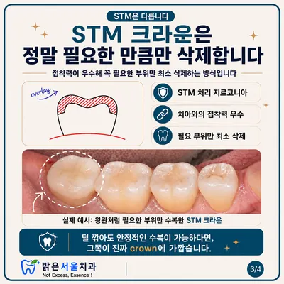 밝은서울치과의원 — 업체가 네이버 플레이스에 올린 사진 3