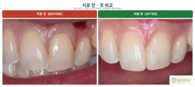 이동연합치과의원 포항 — 업체가 네이버 플레이스에 올린 사진 2