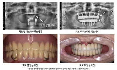 이동연합치과의원 포항 — 업체가 네이버 플레이스에 올린 사진 3