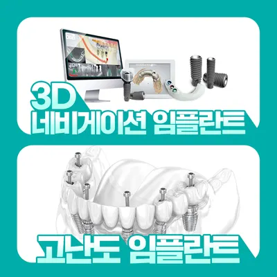올봄플란트치과의원 — 업체가 네이버 플레이스에 올린 사진 2