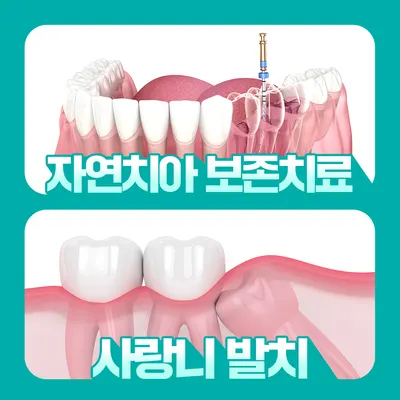 올봄플란트치과의원 — 업체가 네이버 플레이스에 올린 사진 3