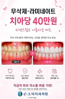 e-스타치과의원 — 업체가 네이버 플레이스에 올린 사진 3