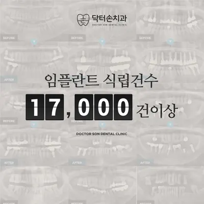 닥터손치과의원 — 업체가 네이버 플레이스에 올린 사진 2