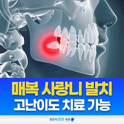 천안더맑은치과의원 — 업체가 네이버 플레이스에 올린 사진 3