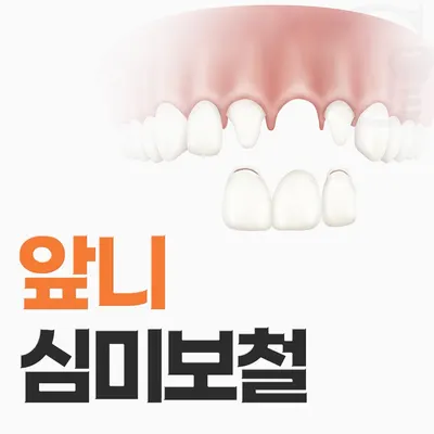 고운플란트치과의원 — 업체가 네이버 플레이스에 올린 사진 3
