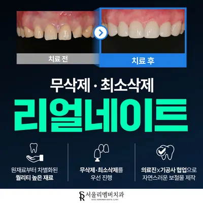서울리멤버치과의원 — 업체가 네이버 플레이스에 올린 사진 2