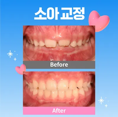 프라임에스치과교정과치과의원 — 업체가 네이버 플레이스에 올린 사진 2