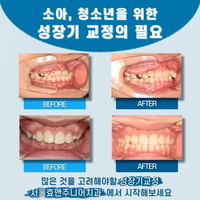 서울효앤주니어소아치과의원 — 업체가 네이버 플레이스에 올린 사진 3