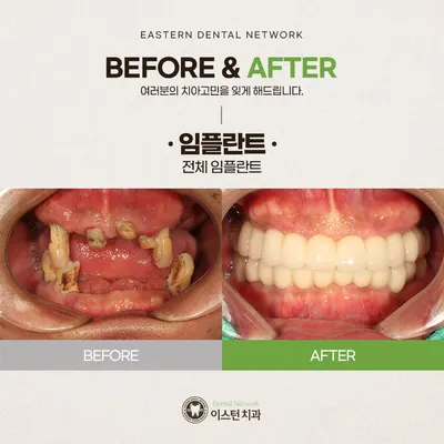 이스턴치과의원 — 업체가 네이버 플레이스에 올린 사진 2