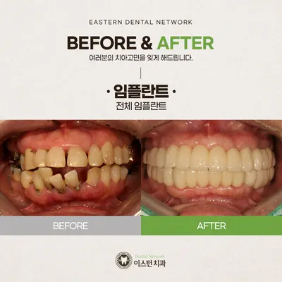 이스턴치과의원 — 업체가 네이버 플레이스에 올린 사진 3