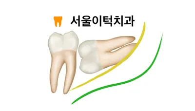 서울이턱사랑니치과의원 — 업체가 네이버 플레이스에 올린 사진 3