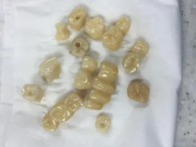 마루치과기공소 — 업체가 네이버 플레이스에 올린 사진 3