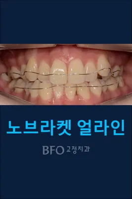 비에프오교정치과의원 — 업체가 네이버 플레이스에 올린 사진 2