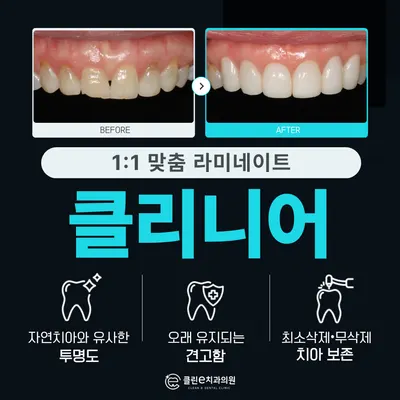 클린이치과의원 감일본점 — 업체가 네이버 플레이스에 올린 사진 2