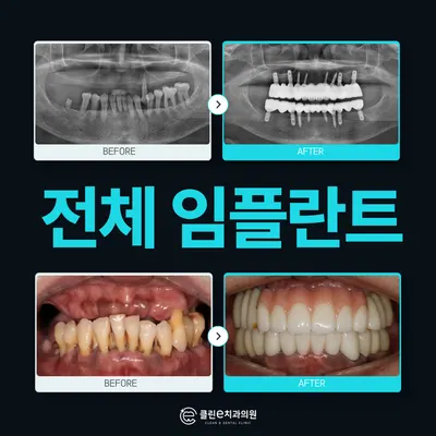 클린이치과의원 감일본점 — 업체가 네이버 플레이스에 올린 사진 3