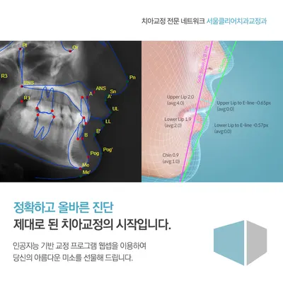 서울클리어치과교정과치과의원 — 업체가 네이버 플레이스에 올린 사진 3