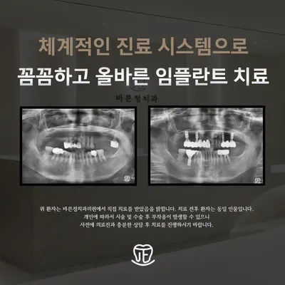 바른정치과의원 — 업체가 네이버 플레이스에 올린 사진 2