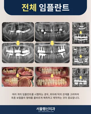 서울행신치과의원 — 업체가 네이버 플레이스에 올린 사진 2