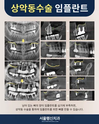 서울행신치과의원 — 업체가 네이버 플레이스에 올린 사진 3