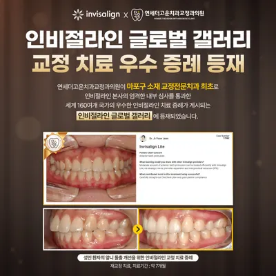 연세더고운치과교정과의원 — 업체가 네이버 플레이스에 올린 사진 2