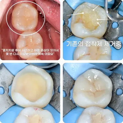김동건바른치과의원 부평동암 — 업체가 네이버 플레이스에 올린 사진 2