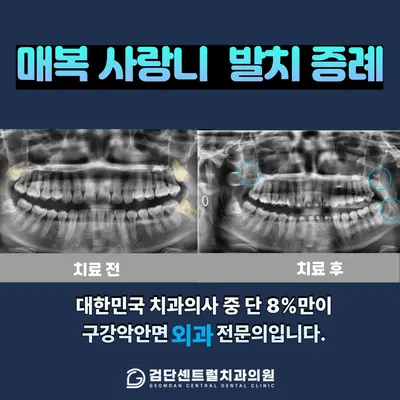 검단센트럴치과의원 — 업체가 네이버 플레이스에 올린 사진 3